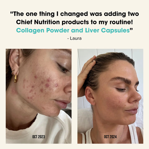 Glowing Skin Bundle Chief Nutrition